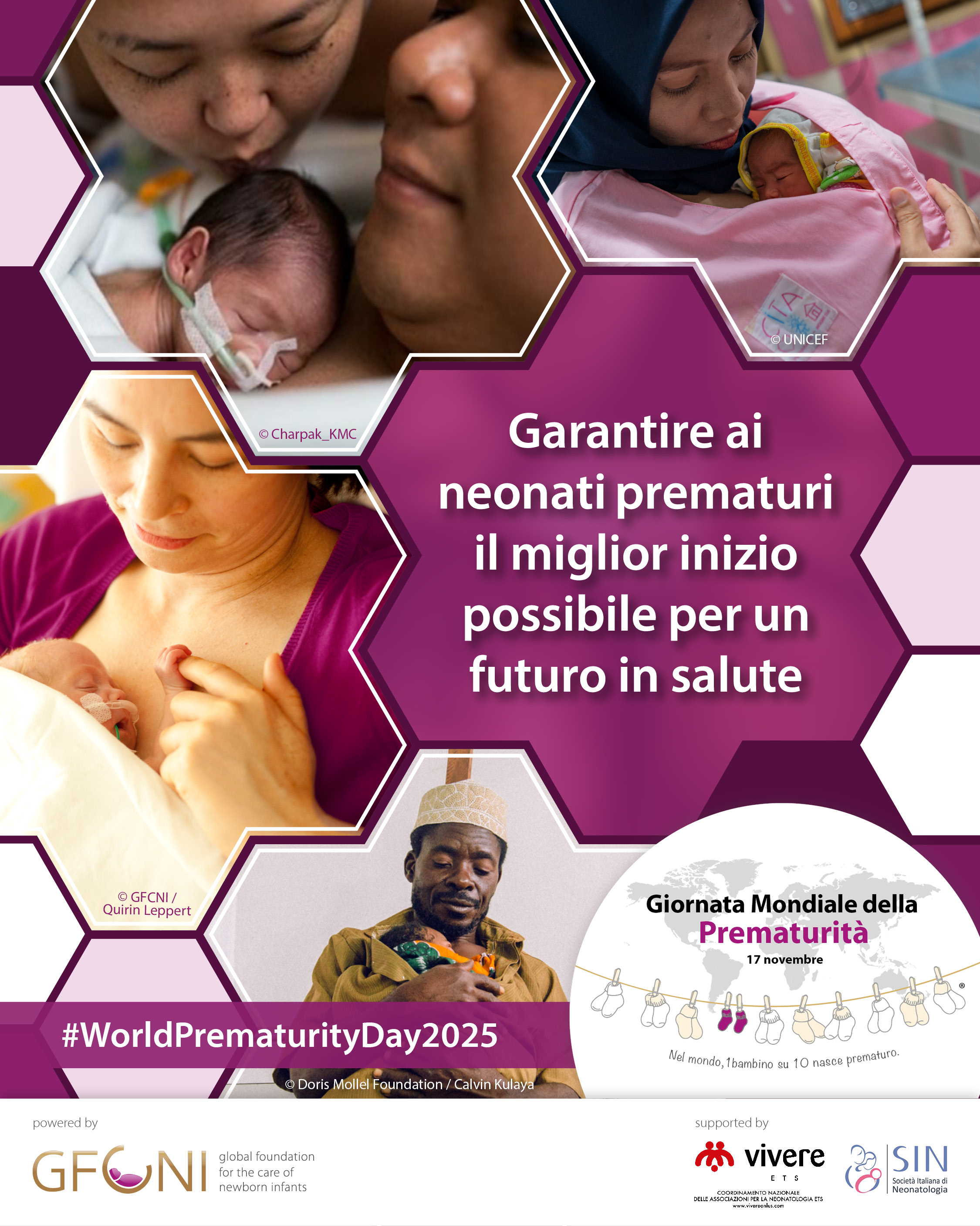 PREMATURITÀ: LA SIN INSIEME AL NEONATO E ALLA SUA FAMIGLIA  PER IL DIRITTO A UNA VITA IN SALUTE